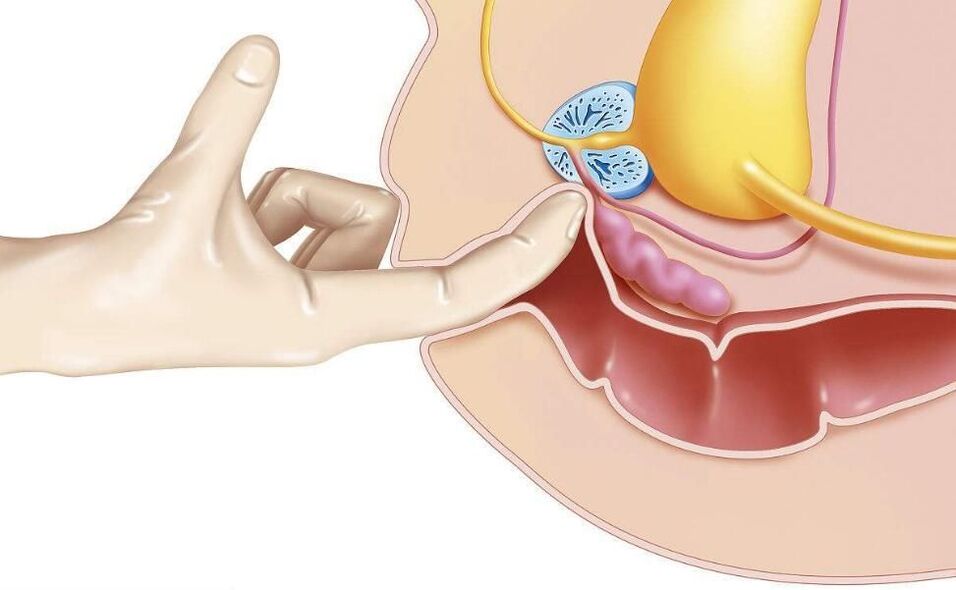 massage de la prostate