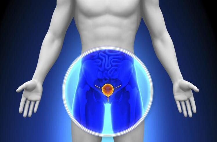 Les premiers signes et symptômes de la prostatite chez les hommes